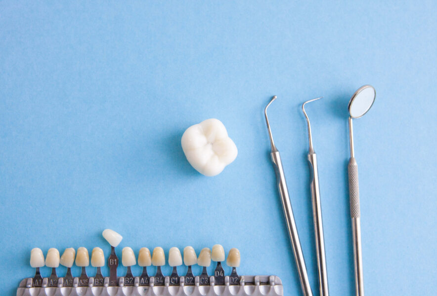 根管治療中における仮歯のメリット・デメリット、仮歯期間に注意することや取れた場合の対処法について解説