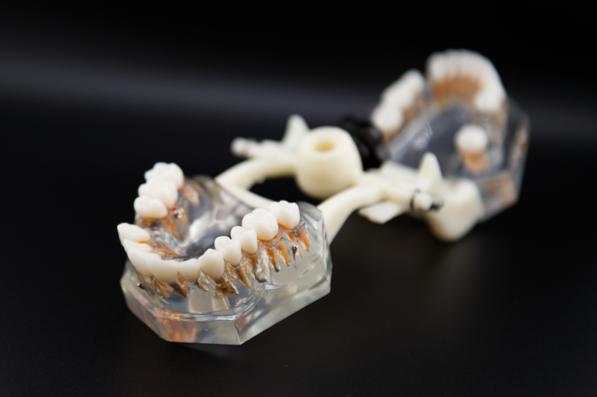 根管治療と歯内療法の違い